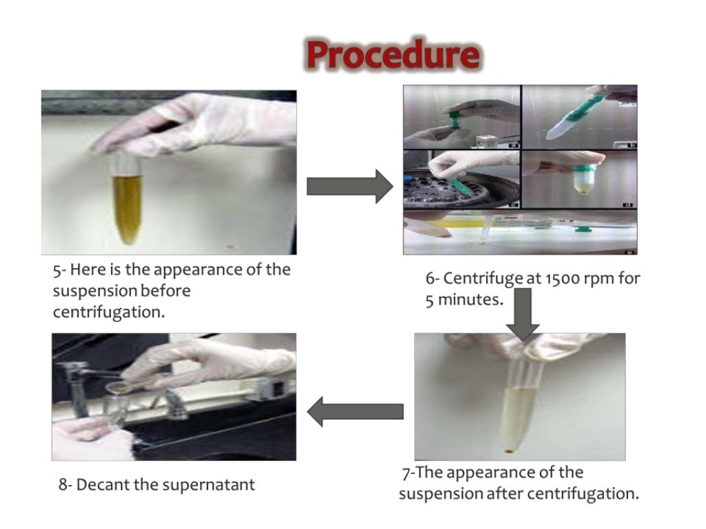 stool analysis