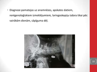 • Diagnoze pamatojas uz anamnēzes, apskates datiem,
rentgenoloģiskiem izmeklējumiem, laringoskopiju izdara tikai pēc
vairākām dienām, sāpīguma dēļ.
10
 
