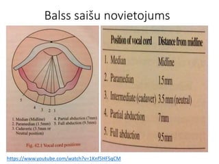 Balss saišu novietojums
https://www.youtube.com/watch?v=1Knf5HFSqCM
 