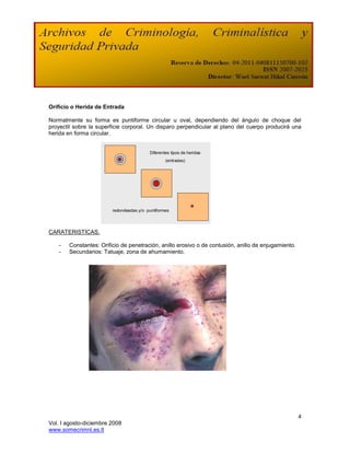 Orificio o Herida de Entrada

Normalmente su forma es puntiforme circular u oval, dependiendo del ángulo de choque del
proyectil sobre la superficie corporal. Un disparo perpendicular al plano del cuerpo producirá una
herida en forma circular.


                                         Diferentes tipos de heridas
                                                 (entradas)




                        redondeadas y/o puntiformes




CARATERISTICAS.

   -   Constantes: Orificio de penetración, anillo erosivo o de contusión, anillo de enjugamiento.
   -   Secundarios: Tatuaje, zona de ahumamiento.




                                                                                                     4
Vol. I agosto-diciembre 2008
www.somecrimnl.es.tl
 