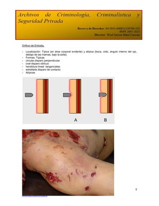 Orificio de Entrada.

-   Localización: Típica (en área corporal evidente) y atípica (boca, oído, ángulo interno del ojo,
    debajo de las mamas, bajo la axila).
-   Formas: Típicas
-   circular,disparo perpendicular
-   oval disparo oblícuo
-   hendidura lineal tangenciales
-   estrellada disparo de contacto
-   Atípicas




                                             A                         B




                                                                                                 5
Vol. I agosto-diciembre 2008
www.somecrimnl.es.tl
 