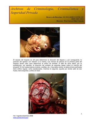 El estudio del trayecto es útil para determinar la dirección del disparo y, por consiguiente, la
posición del agresor con relación a la víctima. Las marcas de pólvora en la primera parte del
trayecto tienen valor para determinar el orifico de entrada. A falta de otros datos, por la
putrefacción, por ejemplo, la dirección del arrastre de esquirlas óseas indica la marcha del
proyectil. En los huesos planos (cráneo, costillas, etc..) hay datos ciertos: la tabla primero perforada
tiene orificio regular, como sacabocados, mientras la segunda, aquella por donde salió de ese
hueso, tiene esquirlas u orifico en bisel.




                                                                                                      7
Vol. I agosto-diciembre 2008
www.somecrimnl.es.tl
 
