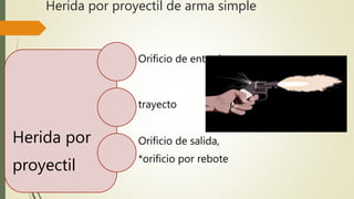 Herida por
proyectil
Orificio de entrada
trayecto
Orificio de salida,
*orificio por rebote
Herida por proyectil de arma simple
 