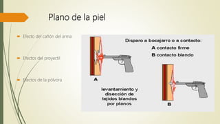Plano de la piel
 Efecto del cañón del arma
 Efectos del proyectil
 Efectos de la pólvora
 