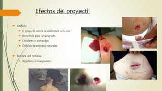 Efectos del proyectil
 Orificio
 El proyectil vence la elasticidad de la piel
 Un orificio para un proyectil
 Circulares o alargados
 Orificios de entrada naturales
 Bordes del orificio
 Regulares e invaginados
 