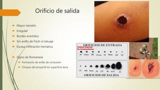 Orificio de salida
 Mayor tamaño
 Irregular
 Bordes evertidos
 Sin anillo de Fisch ni tatuaje
 Escasa infiltración hemática
 Signo de Romanese
 Formación de anillo de contusión
 Choque del proyectil en superficie dura
 
