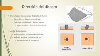 Dirección del disparo
 Incrustación de pólvora y deposito de humo
 Concéntrico = disparo perpendicular
 Excéntrico (media luna) = disparo oblicuo
 Mayor densidad = dirección de procedencia
 Anillo de contusión
 Anillo completo = disparo perpendicular
 Anillo en semiluna = disparo oblicuo
 Marcado del lado de procedencia
 