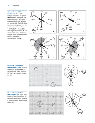 baltazaar ecg.pdf