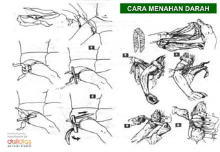 CARA MENAHAN DARAH




Professionally
coordinates by:
 