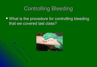 Controlling Bleeding
 What is the procedure for controlling bleeding
 that we covered last class?
 