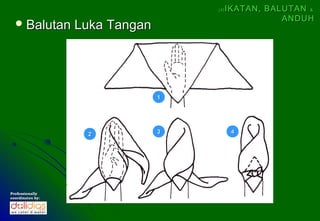(4)   IKATAN, BALUTAN &
                                                     ANDUH
   Balutan       Luka Tangan




                                1




                   2            3          4




Professionally
coordinates by:
 