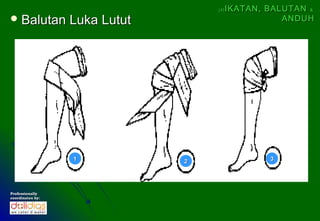 (4)   IKATAN, BALUTAN &
 Balutan         Luka Lutut                        ANDUH




                  1            2                 3




Professionally
coordinates by:
 