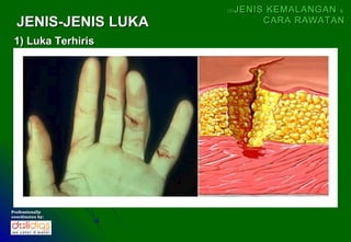 (5)   JENIS KEMALANGAN &
  JENIS-JENIS LUKA              CARA RAWATAN

 1) Luka Terhiris




Professionally
coordinates by:
 