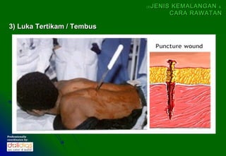 (5)   JENIS KEMALANGAN &
                                        CARA RAWATAN

 3) Luka Tertikam / Tembus




Professionally
coordinates by:
 