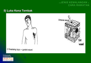 (5)   JENIS KEMALANGAN &
                                  CARA RAWATAN

 5) Luka Kena Tembak




Professionally
coordinates by:
 