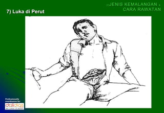 (5)   JENIS KEMALANGAN &
                               CARA RAWATAN
 7) Luka di Perut




Professionally
coordinates by:
 