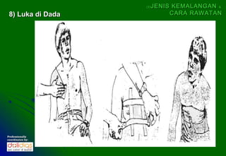 (5)   JENIS KEMALANGAN &
 8) Luka di Dada              CARA RAWATAN




Professionally
coordinates by:
 