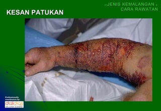 (5)   JENIS KEMALANGAN &
                             CARA RAWATAN
 KESAN PATUKAN




Professionally
coordinates by:
 