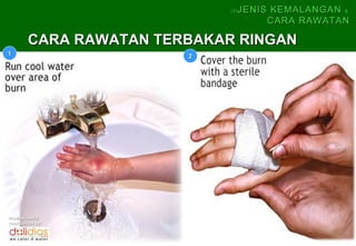 (5)   JENIS KEMALANGAN &
                                        CARA RAWATAN

        CARA RAWATAN TERBAKAR RINGAN
1                       2




Professionally
coordinates by:
 