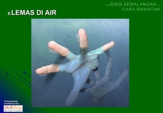 (5)   JENIS KEMALANGAN &
                                 CARA RAWATAN
   9.  LEMAS DI AIR




Professionally
coordinates by:
 