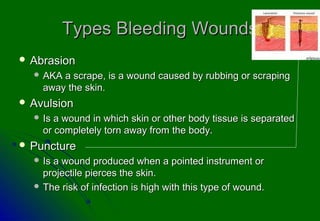Types Bleeding Wounds
 Abrasion
   AKA a scrape, is a wound caused by rubbing or scraping
    away the skin.
 Avulsion
   Is a wound in which skin or other body tissue is separated
    or completely torn away from the body.
 Puncture
   Isa wound produced when a pointed instrument or
    projectile pierces the skin.
   The risk of infection is high with this type of wound.
 