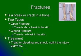 Fractures
 Isa break or crack in a bone.
 Two Types
   Open     Fracture
        There   is also a break in the skin.
   Closed     Fracture
        There   is no break in the skin.
 Treatment
   Treat    for bleeding and shock, splint the injury,
       apply ice.
 