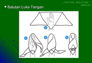 Balutan Luka TanganBalutan Luka Tangan
11
22 33 44
(4)(4) IKATAN, BALUTANIKATAN, BALUTAN &&
ANDUHANDUH
 