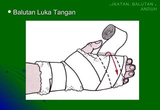  Balutan Luka TanganBalutan Luka Tangan
(4)(4) IKATAN, BALUTANIKATAN, BALUTAN &&
ANDUHANDUH
 
