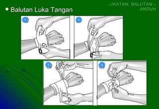  Balutan Luka TanganBalutan Luka Tangan
11 22
33 44
(4)(4) IKATAN, BALUTANIKATAN, BALUTAN &&
ANDUHANDUH
 