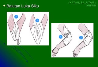  Balutan Luka SikuBalutan Luka Siku
11
22
11 22
(4)(4) IKATAN, BALUTANIKATAN, BALUTAN &&
ANDUHANDUH
 