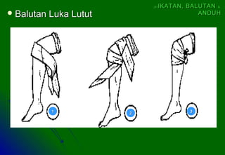  Balutan Luka LututBalutan Luka Lutut
11 22 33
(4)(4) IKATAN, BALUTANIKATAN, BALUTAN &&
ANDUHANDUH
 