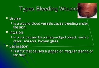 Types Bleeding WoundsTypes Bleeding Wounds
 BruiseBruise
Is a wound blood vessels cause bleeding underIs a wound blood vessels cause bleeding under
the skin.the skin.
 IncisionIncision
Is a cut caused by a sharp-edged object, such aIs a cut caused by a sharp-edged object, such a
razor, scissors, broken glass.razor, scissors, broken glass.
 LacerationLaceration
Is a cut that causes a jagged or irregular tearing ofIs a cut that causes a jagged or irregular tearing of
the skin.the skin.
 