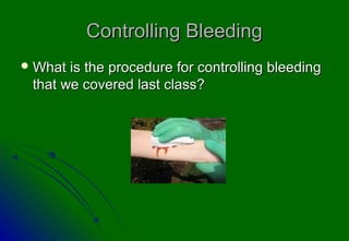 Controlling BleedingControlling Bleeding
 What is the procedure for controlling bleedingWhat is the procedure for controlling bleeding
that we covered last class?that we covered last class?
 