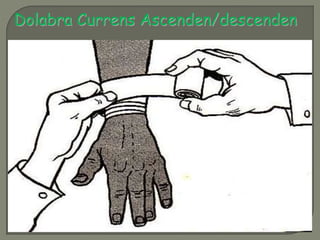Dolabra Currens Ascenden/descenden 
 