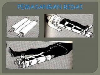 PEMASANGAN BIDAI 
 
