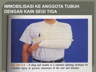 IMMOBILISASI KE ANGGOTA TUBUH 
DENGAN KAIN SEGI TIGA 
 