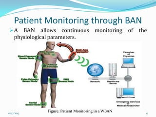 Patient Monitoring through BAN
A

BAN allows continuous
physiological parameters.

10/27/2013

monitoring

Figure: Patient Monitoring in a WBAN

of

the

12

 