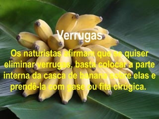 Verrugas Os naturistas afirmam que se quiser eliminar verrugas, basta colocar a parte interna da casca de banana sobre elas e prendê-la com gase ou fita cirúgica.   