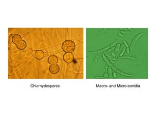 Chlamydospores Macro- and Micro-conidia
 
