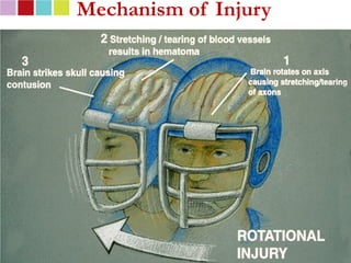 Mechanism of Injury




19
 