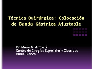 Dr. Mario N. Antozzi
Centro de Cirugías Especiales y Obesidad
Bahia Blanca
 