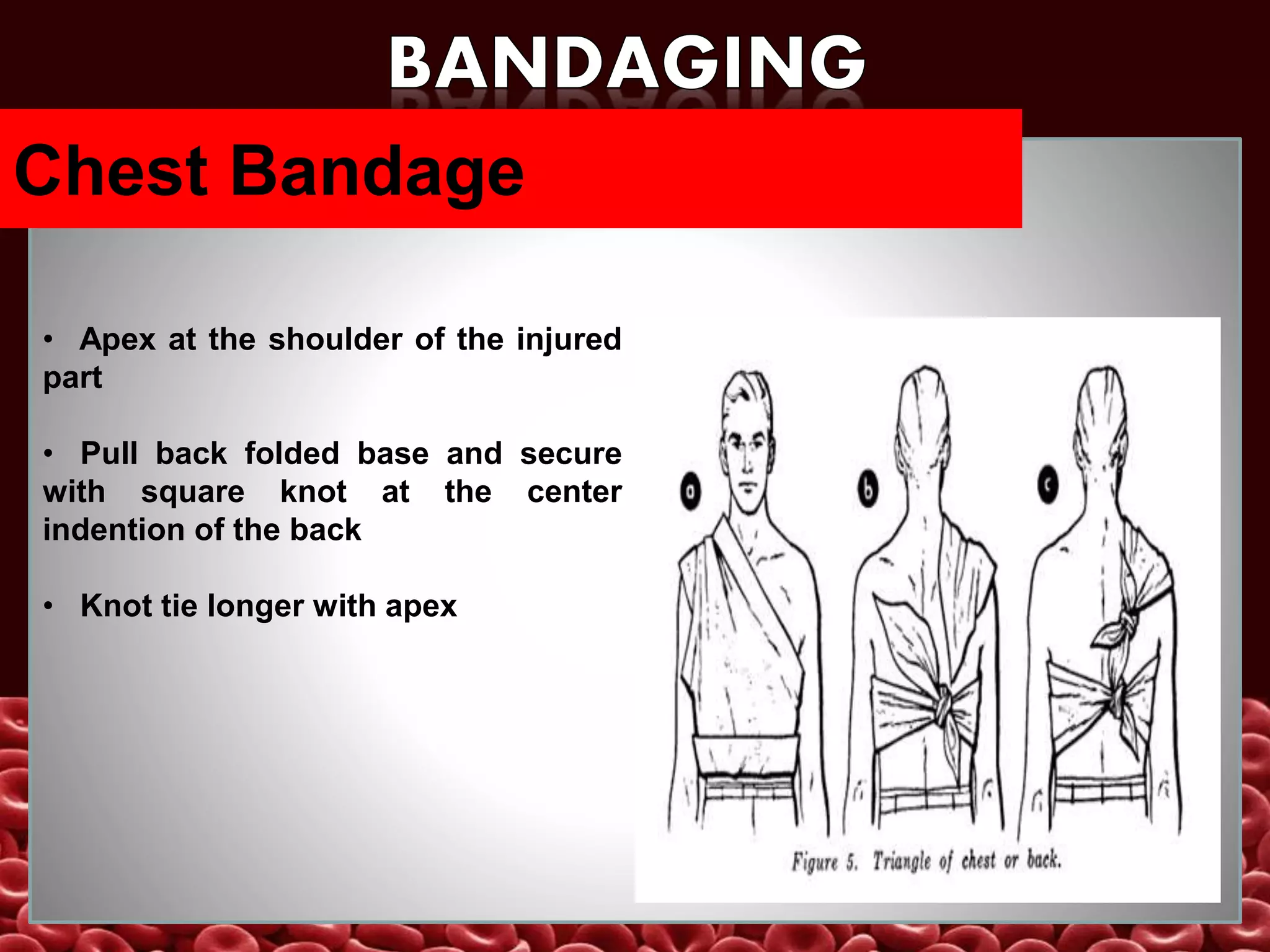 Bandage ppt