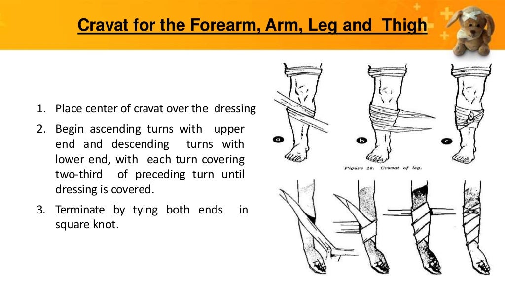 BANDAGING TRIANGULAR BANDAGING AND CRAVAT, TYPES OF KNOTS