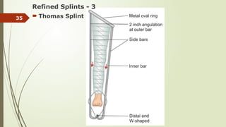 Thomas Splint Labelled BANDAGES AND BANDAGING.pptx - ALAGBE OLUWATOSIN A. | PPTX
