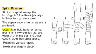 Spiral Reverse
Similar to spiral, except the
bandage is folded back (distally)
halfway through each pass.
The appearance a basket weave is
produced.
Uses : May hold better on arms,
legs, thighs (extremities that are
wider at one end than the other-
cone shape) than spiral alone.
Promotes venous return.
Holds dressings in place.
 