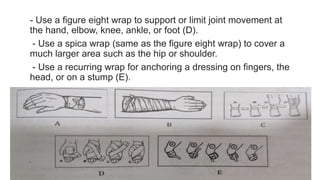 - Use a figure eight wrap to support or limit joint movement at
the hand, elbow, knee, ankle, or foot (D).
- Use a spica wrap (same as the figure eight wrap) to cover a
much larger area such as the hip or shoulder.
- Use a recurring wrap for anchoring a dressing on fingers, the
head, or on a stump (E).
 