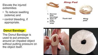 Elevate the injured
extremities
• To reduce swelling
(edema) and
• control bleeding, if
appropriate.
Donut Bandage
The Donut Bandage is
used to put pressure
around an impaled object
without putting pressure on
the object itself.
 
