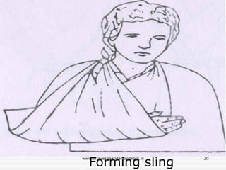 Forming sling
20www.drjayeshpatidar.blogspot.in
 
