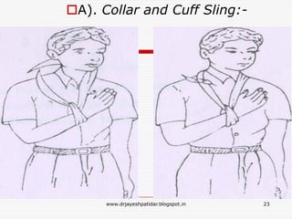 A). Collar and Cuff Sling:-
23www.drjayeshpatidar.blogspot.in
 