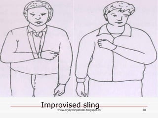 Improvised sling 28www.drjayeshpatidar.blogspot.in
 